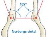 Hundöga